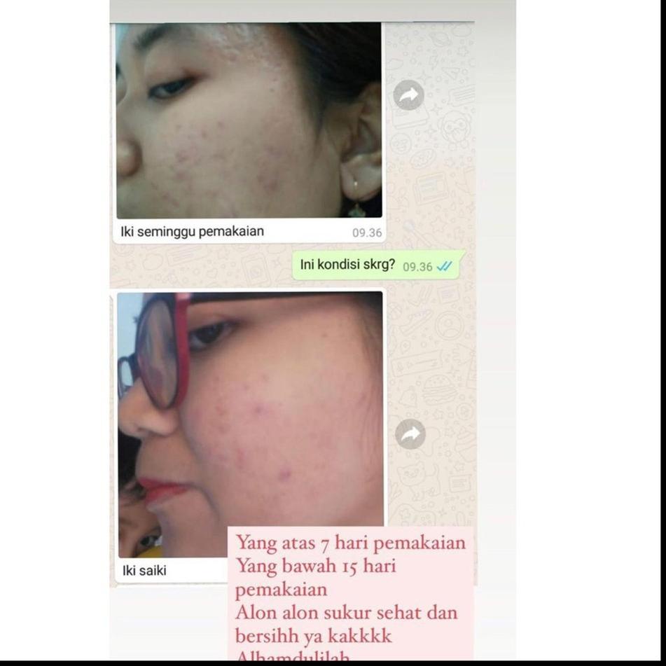 SERUM ADERA FACE SERUM ORIGINAL WAJAH ORI UNTUK FLEK HITAM GLOWING ORI ASLI 100% SERUM ADERA WAJAH O