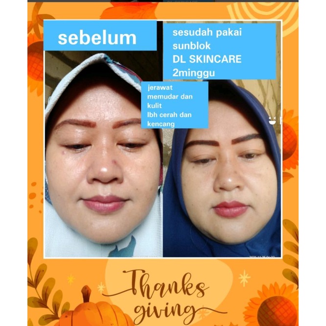 sunblok DL SKINCARE