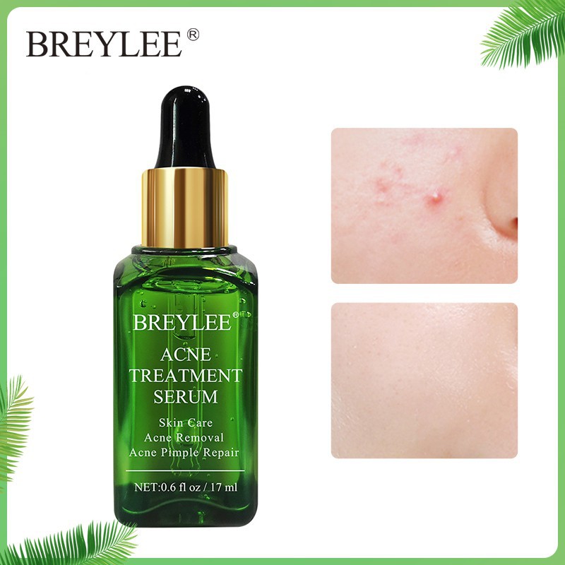 BREYLEE SERUM 17ML BREYLEE VIT C SERUM RETINOL HYALURONIC ROSE GOLD SERUM ACNE SERUM SOOTHING SERUM