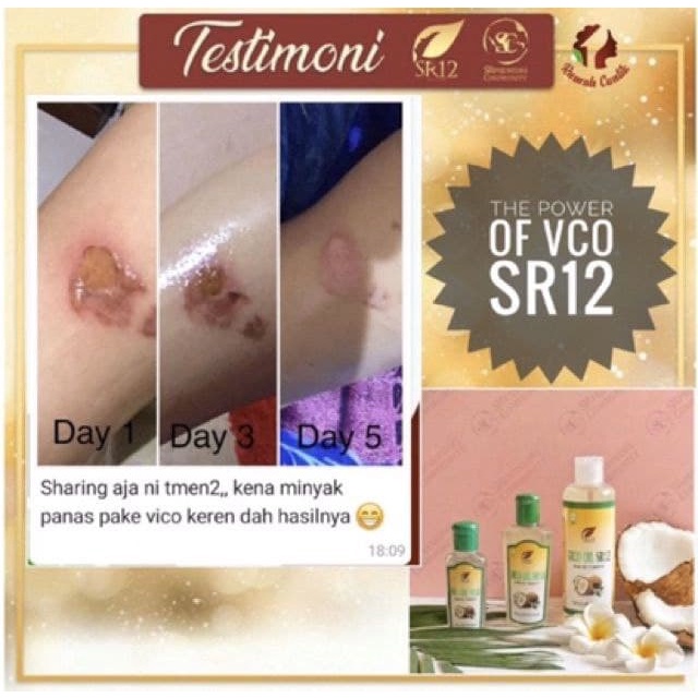 Suplemen Kesehatan VCO Virgin Coconut Oil SR12  Minyak Kelapa Untuk Rambut Pelembab Kulit Kering Herbal Aman BPOM S98