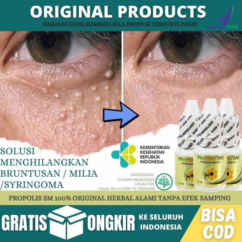 Obat Oles Bruntusan Di Wajah, Bruntusan Biang Keringat, Obat Bruntusan Akibat Kosmestik lHerbalAlami
