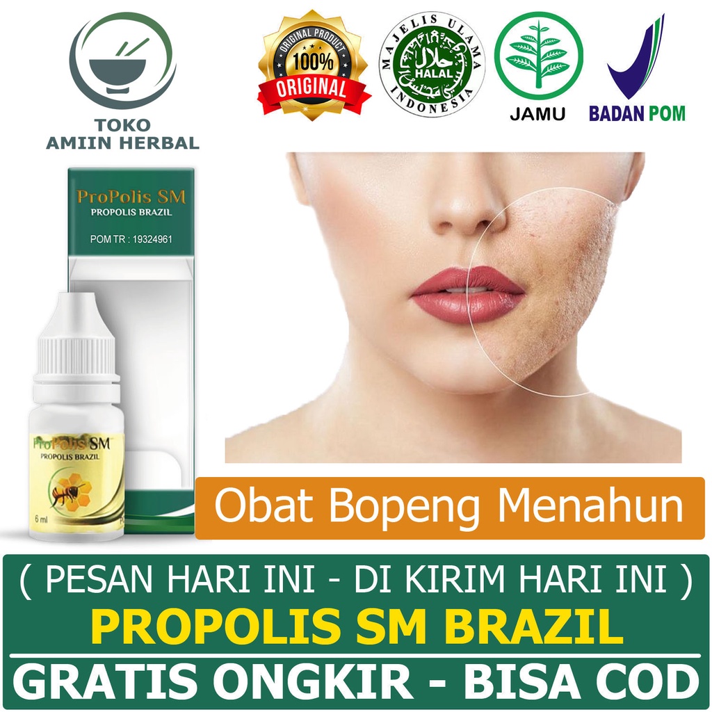 Obat Penghilang Bopeng Bekas Jerawat Cacar Di Wajah Komedo Pori Pori Besar Pria Wanita Propolis SM H