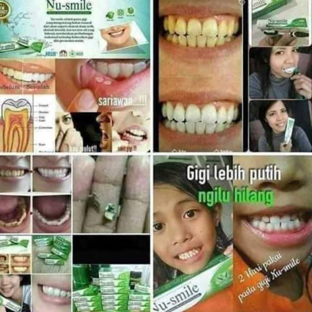 Nu smile