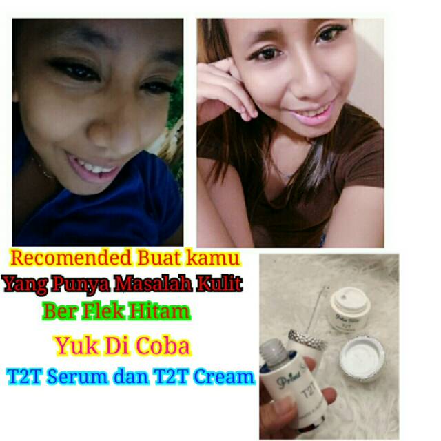T2T Cream dan T2T Serum