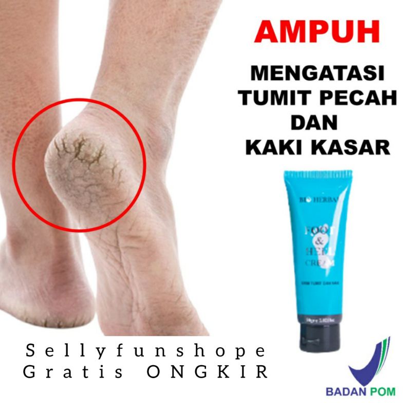 TUMITKU TUMIT FOOT CREAM OBAT KAKI PECAH DAN KERING KRIM KAKI BPOM HERBAL