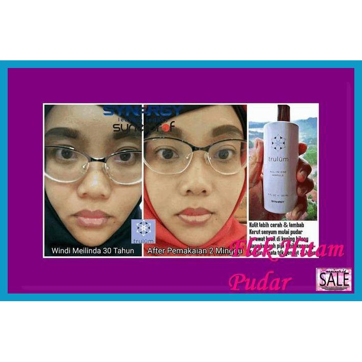 

TAMAMIRK- CREAM UNTUK FLEK HITAM | PEMUTIH WAJAH ALAMI NON KIMIA -ASLIII.