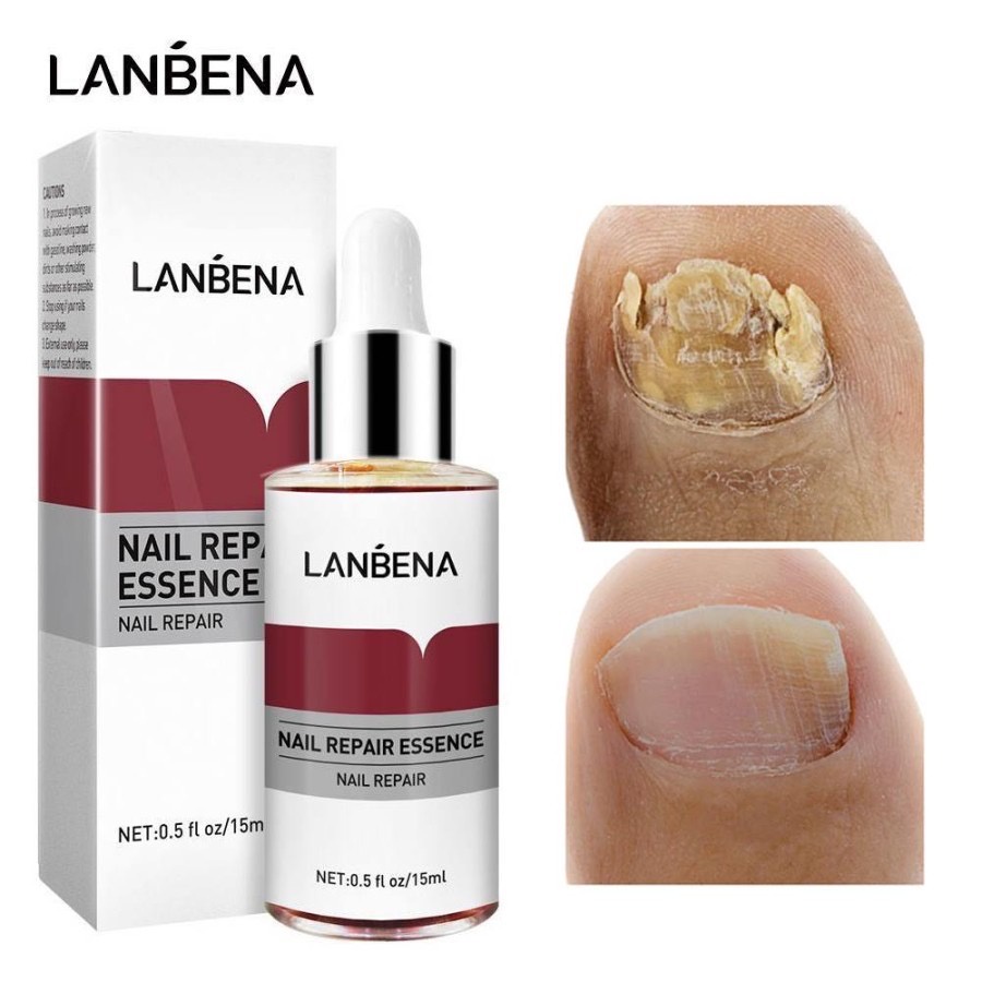 TERBARU LANBENA Nail Repair Essence || Serum kuku rusak jamuran / obat kuku