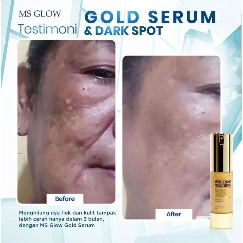 Paket Ultimate+Serum Gold whitening glowing MS GLOW