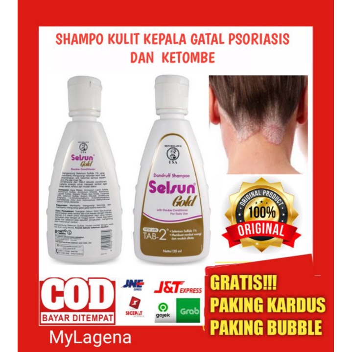 SHAMPO KULIT KEPALA GATAL PSORIASIS DAN  KETOMBE