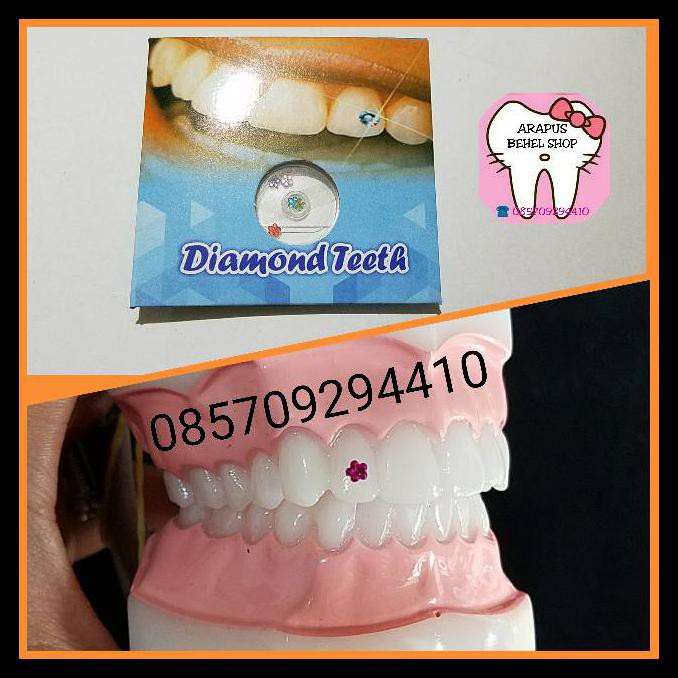 Diskon Wom2805 Permata Gigi Diamond Teeth Motif Bintang Bunga Love Kotak Pita Kupu Kupu 3d Color