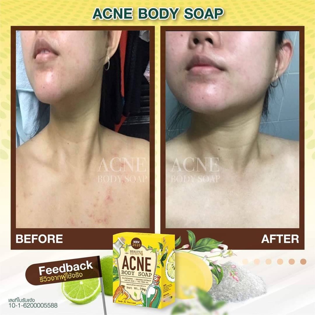 [TERMURAH] Beauty Secret Acne Body Soap | Sabun Jerawat | Jerawat Punggung Badan | Best Seller di Thailand