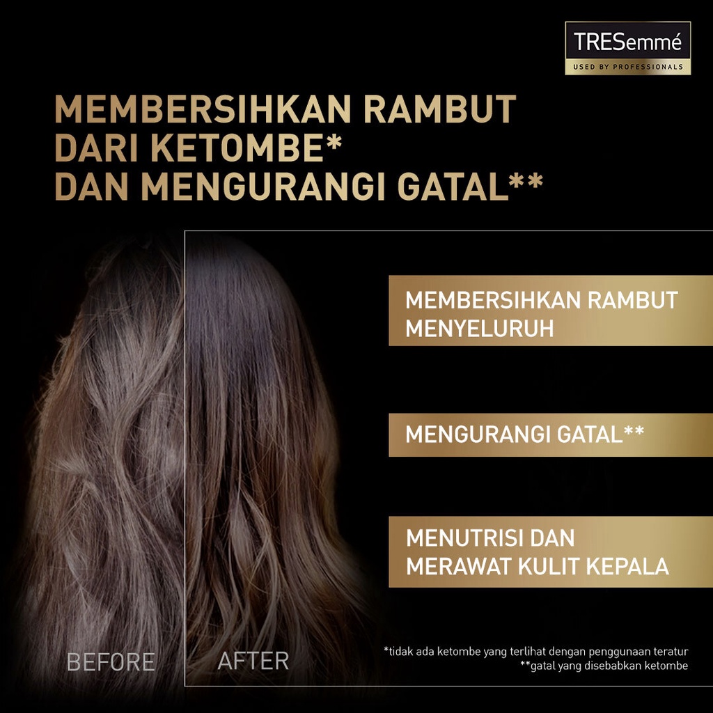 ★ BB ★  Tresemme Scalp Care Shampoo 340ml - Shampo Anti Ketombe Dan Rontok