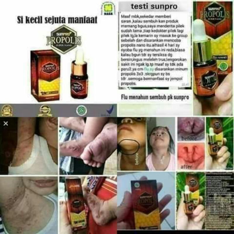 

madu sunpropolis