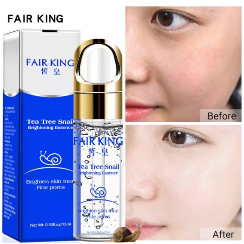 Fair king tea tree snail brightening serum 15 ml best seller china