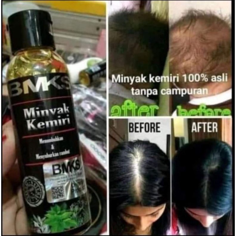 BMKS MINYAK KEMIRI ORIGINAL100%