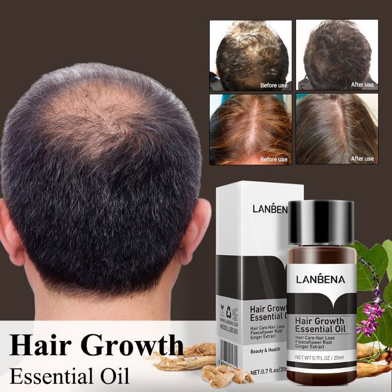 Lanbena Hair Growth Essential Oil Mengatasi Rambut Rontok &amp; Mencegah Kebotakkan / Minyak Memperkuat Akar Rambut / Minyak Penumbuh Rambut / Minyak Penyubur Rambut / Minyak Pelebat Rambut / Minyak Perawatan Rambut Rontok &amp; Botak /Serum Penumbuh Rambut Ampuh