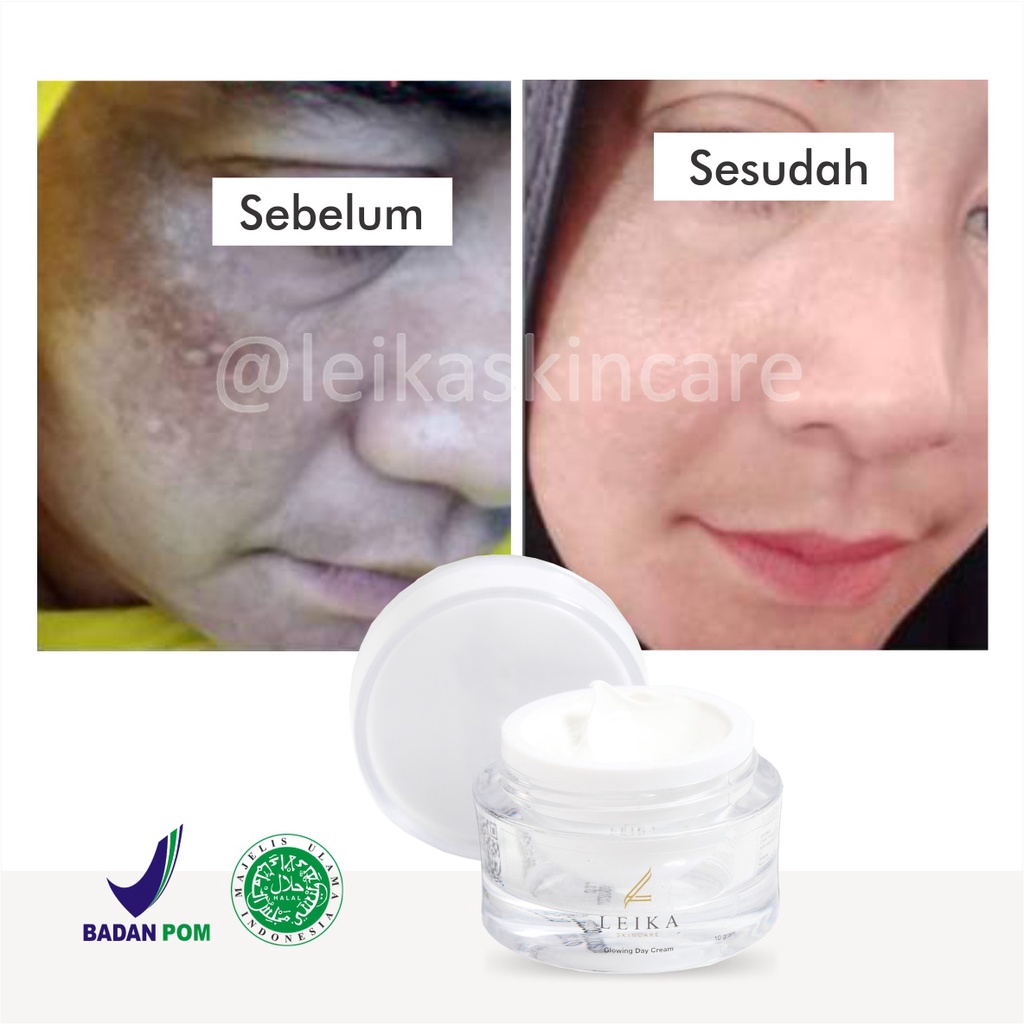 Cream Bagus! Penghilang Flek Hitam Cream Penghilang Flek Hitam Membandel Krim Penghilang Flek Hitam BPOM Halal MUI Ampuh Aman Salep Flek Hitam Glowing Day Cream Leika Skincare Salep Flek Hitam Membandel Paling Ampuh Crem Penghilang Flek Hitam