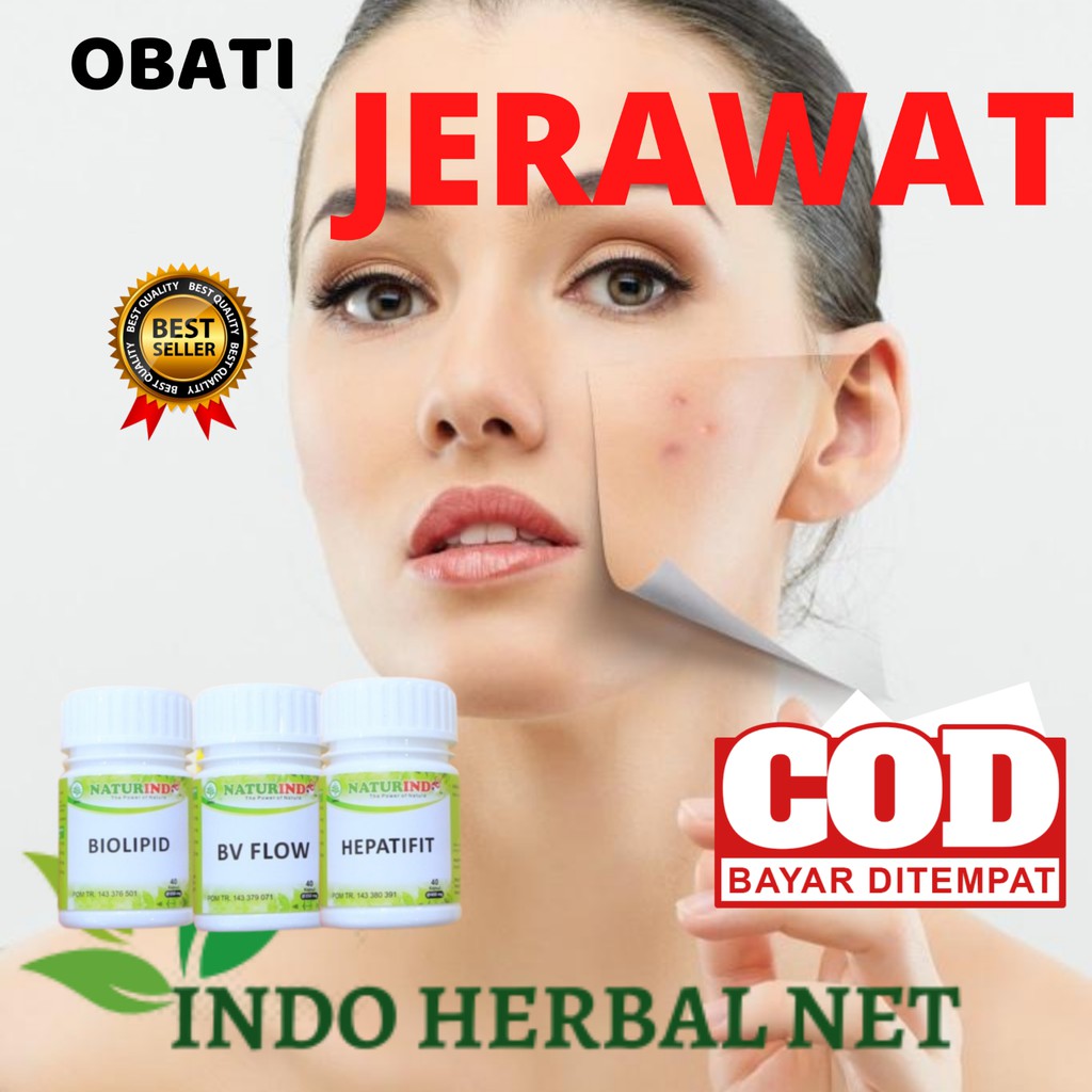 Obat Jerawat Bisul Darah Kotor Gatal Eceran Herbal Naturindo
