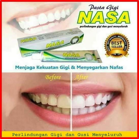 ✿ELYSABETHME✿ Pasta gigi odol nasa obral murah resmi menghilangkan plak dan bau mulut mencegah teeth  berlubang