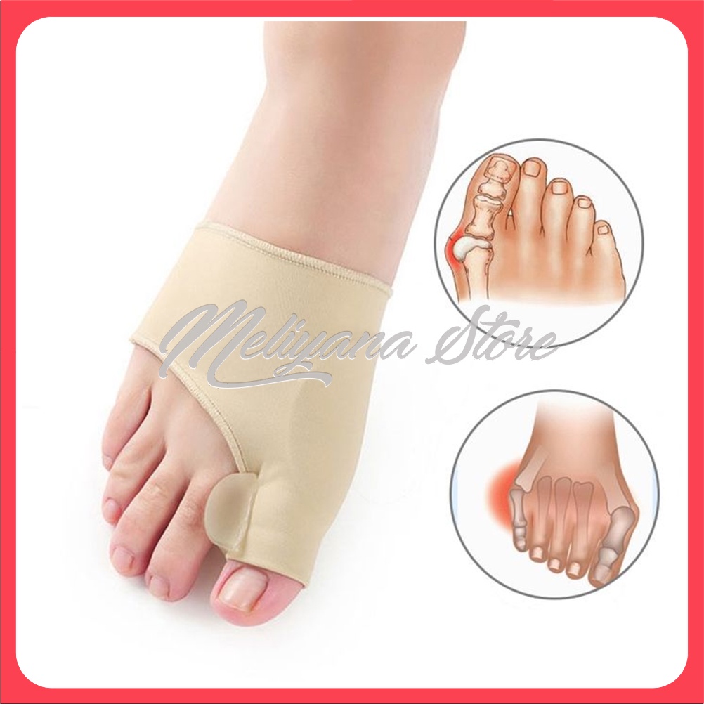 Pelurus jempol kaki, hallux valgus. splint , bunion pad, night splint