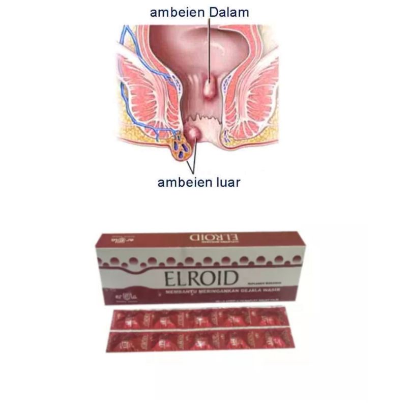 Elroid kaplet wasir 10 Tablet