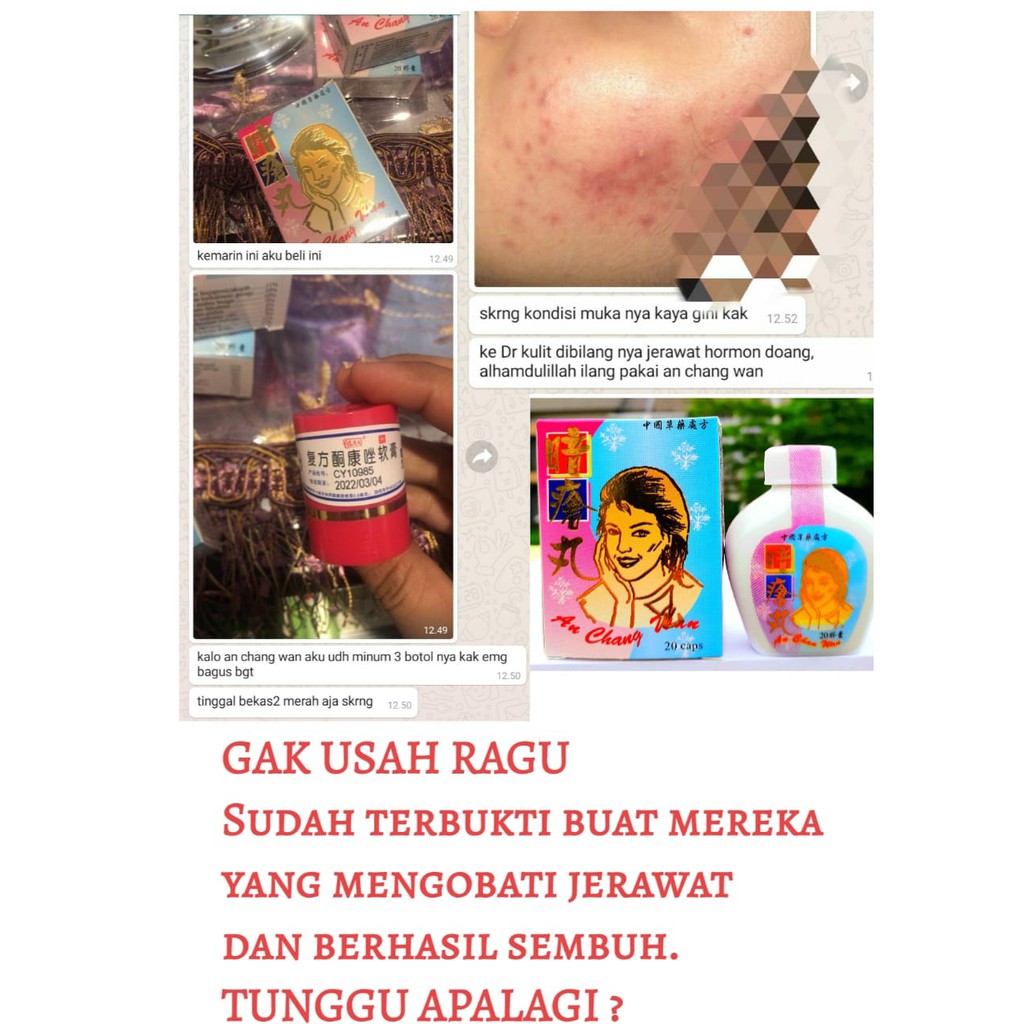 Paket Hemat Perawatan ! OBAT JERAWAT MINUM DAN KRIM PALING AMPUH ANCE CARE WAJAH BADAN SANGAT AMPUH BUKTIKAN SENDIRI