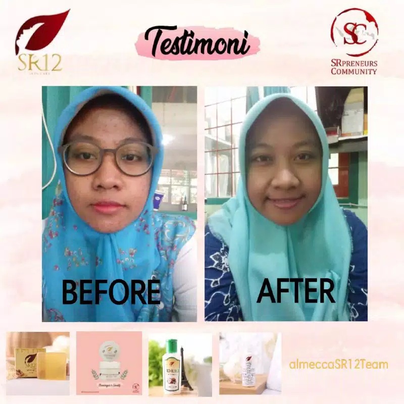 MASKER KEFIR SUSU BPOM//SR12 MILK KEFIR ORIGINAL//TERAMPUH UNTUK KULIT KUSAM &amp; KERING