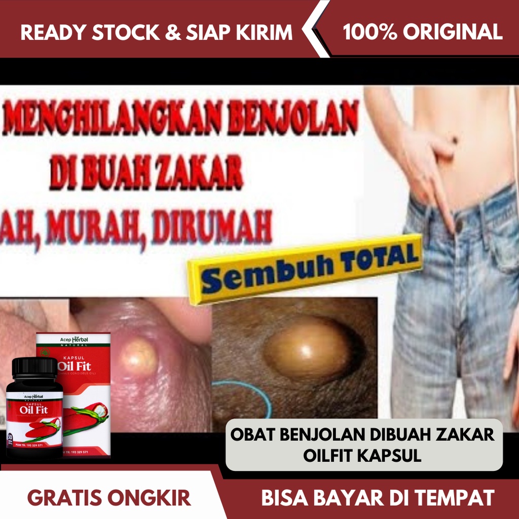 Obat Benjolan Di Buah Zakar, Obat Pengempis Benjolan, Obat Benjolan Di Kulit Buah Zakar, Obat Buah Z