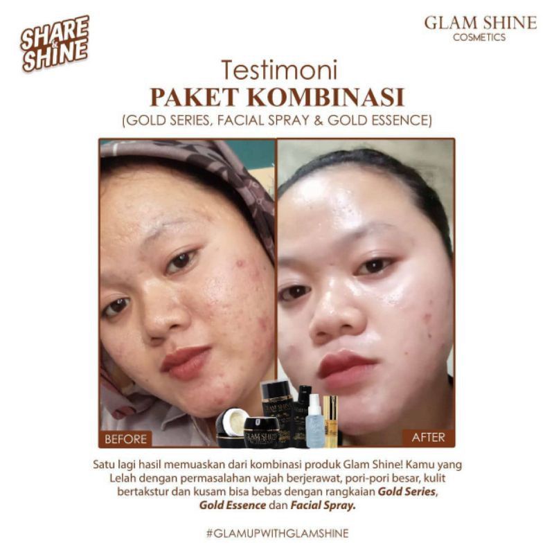 glamshine gold series - cream glamshine - glamshine cream glowing - glamshine black - glamshine platinum - glamshine gold - cream glamshine - skincare glamshine - glamshine Skincare
