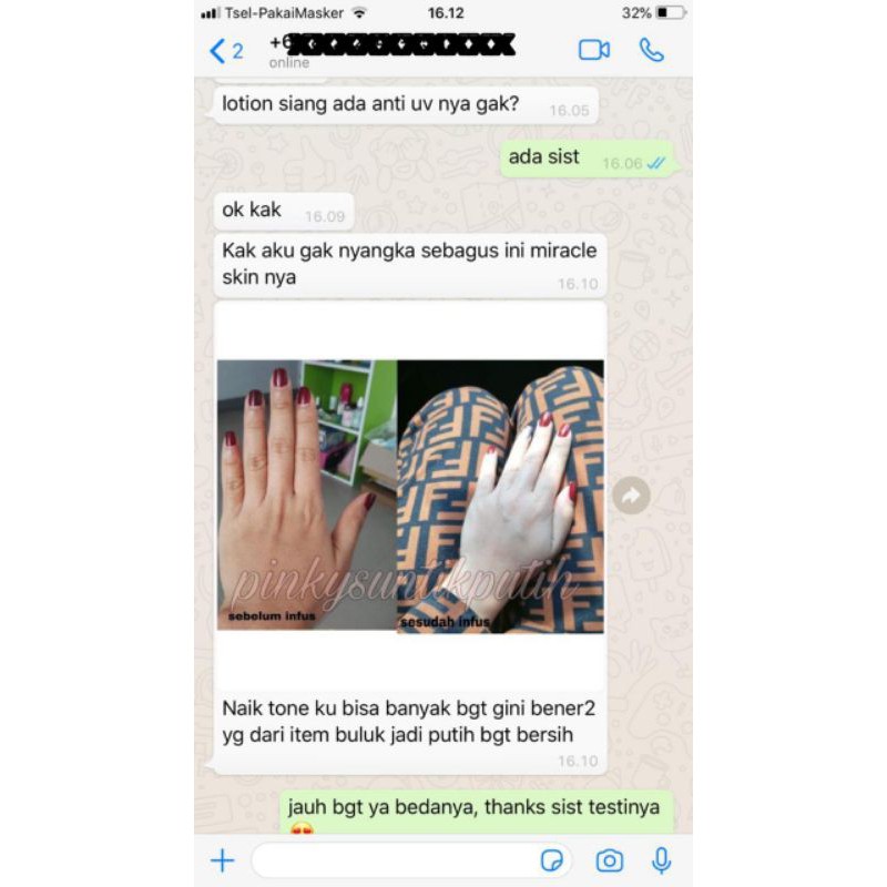 White Pearl Suntik Putih Promo