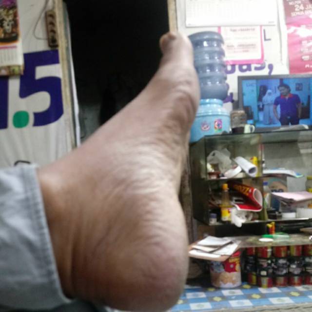debenk