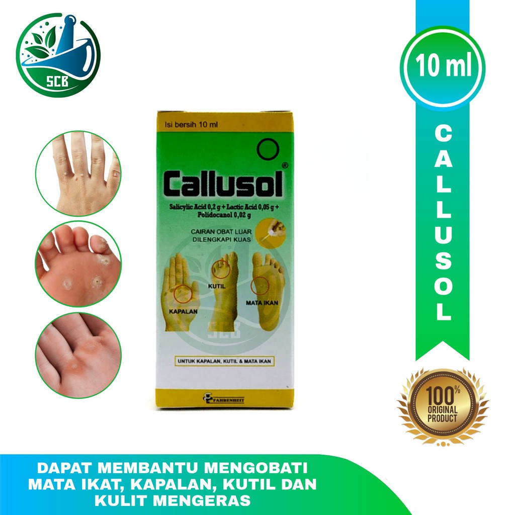 Callusol - Obat Mata ikan,Kutil,Kapalan