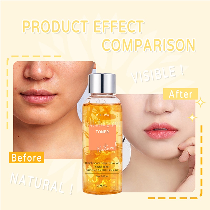 GIRLPAL Helichrysum Deep Hydration Facial Toner Moisturizing Glowing Face Whitening Skincare Facial Serum Essence