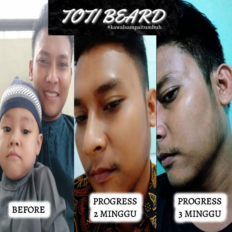 SERUM KHUSUS PENUMBUH BULU BREWOK TANPA GEN #TOTIBEARDSERUM