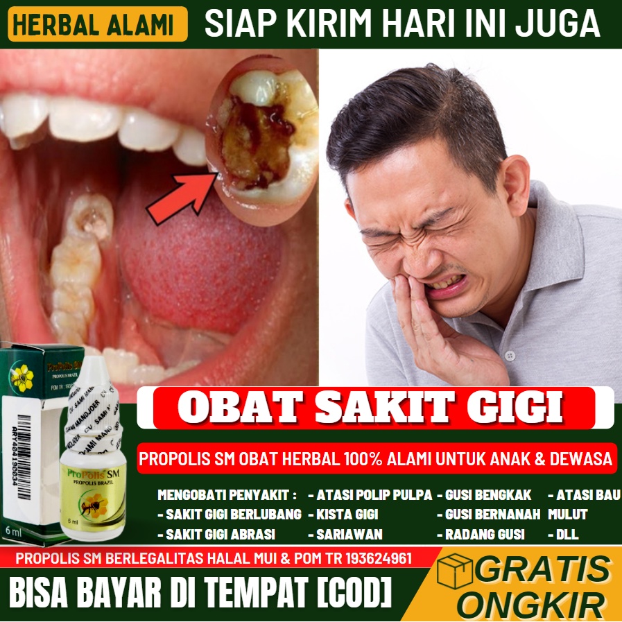 Obat Herbal Sakit Gigi Untuk Anak & Dewasa, Gigi Berlubang, Sariawan, Polip Gigi, Propolis SM ASLI