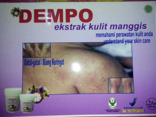 1 Box Isi 3 Pc Cream Dempo Ekstrak Kulit Manggis Herbal Ori