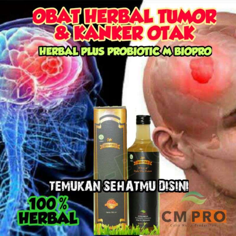 OBAT HERBAL TUMOR OTAK l OBAT KANKER OTAK HERBAL