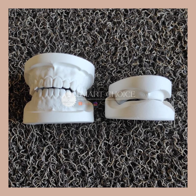 Dental model study gips / model gigi gips / model study gipsum gypsum praktikum white/gips putih