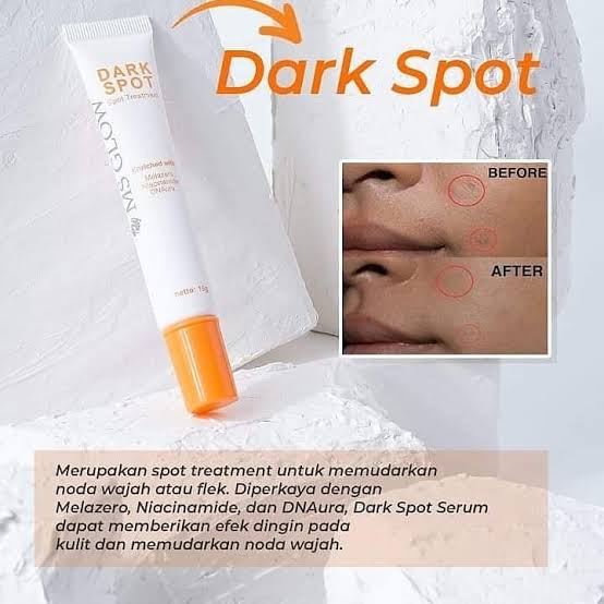 Dark Spot Serum MS Glow Original Perawatan wajah Bisa Cod