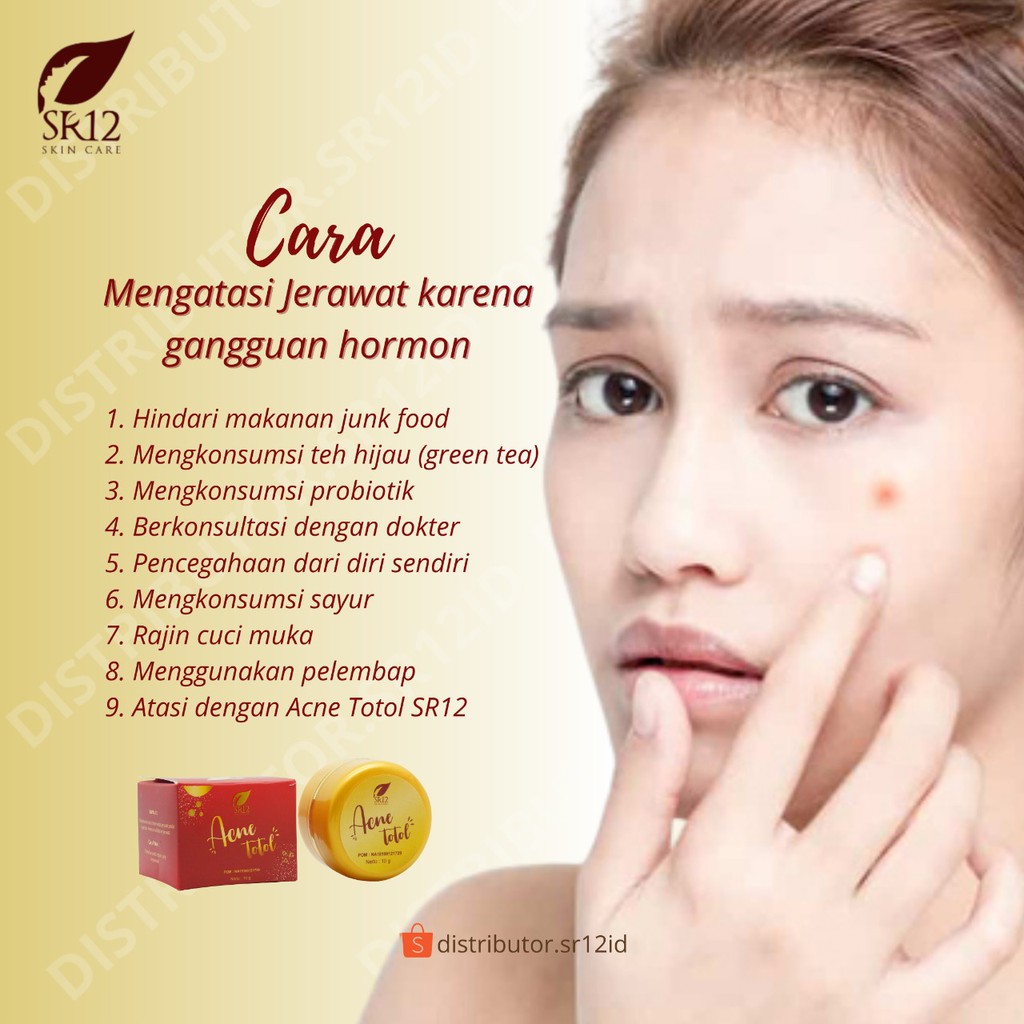 ACNE TOTOL SR12 HERBAL / CREAM OBAT JERAWAT AMPUH / JERAWAT KEMPES KERING / JERAWAT HORMONAL