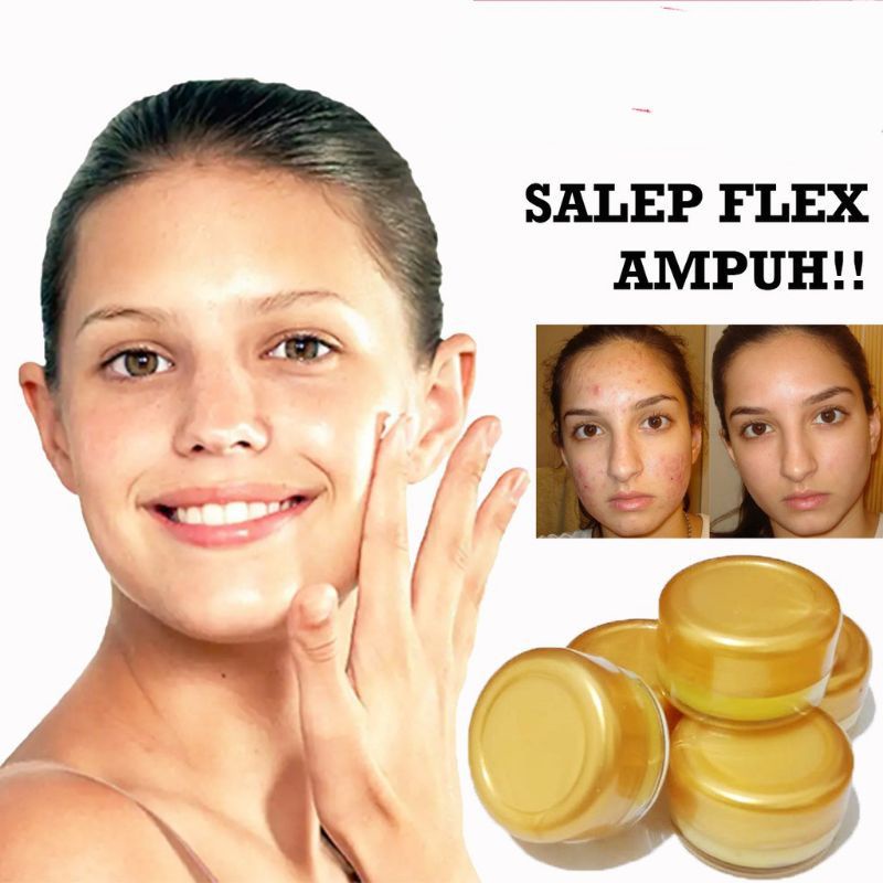 SALEP FLEX HITAM MELASMA AMPUH/Salep wajah untuk menghilangkan flex hitam