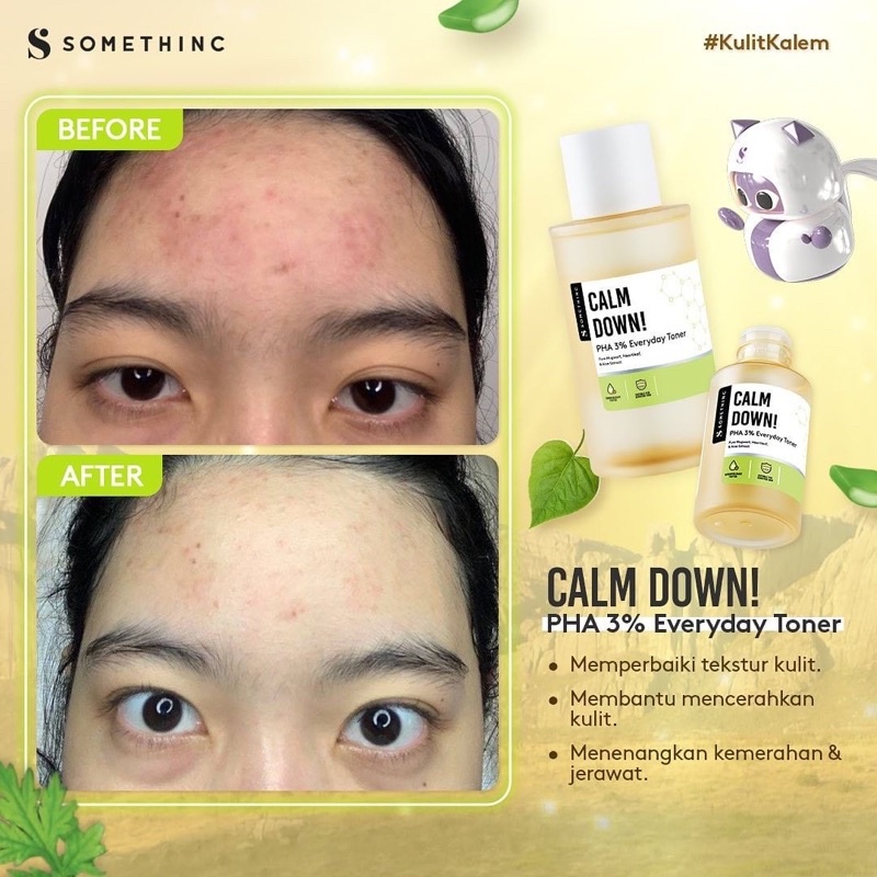 SOMETHINC Calm Down! Skinpair R-Cover Ampoule Serum 30ml