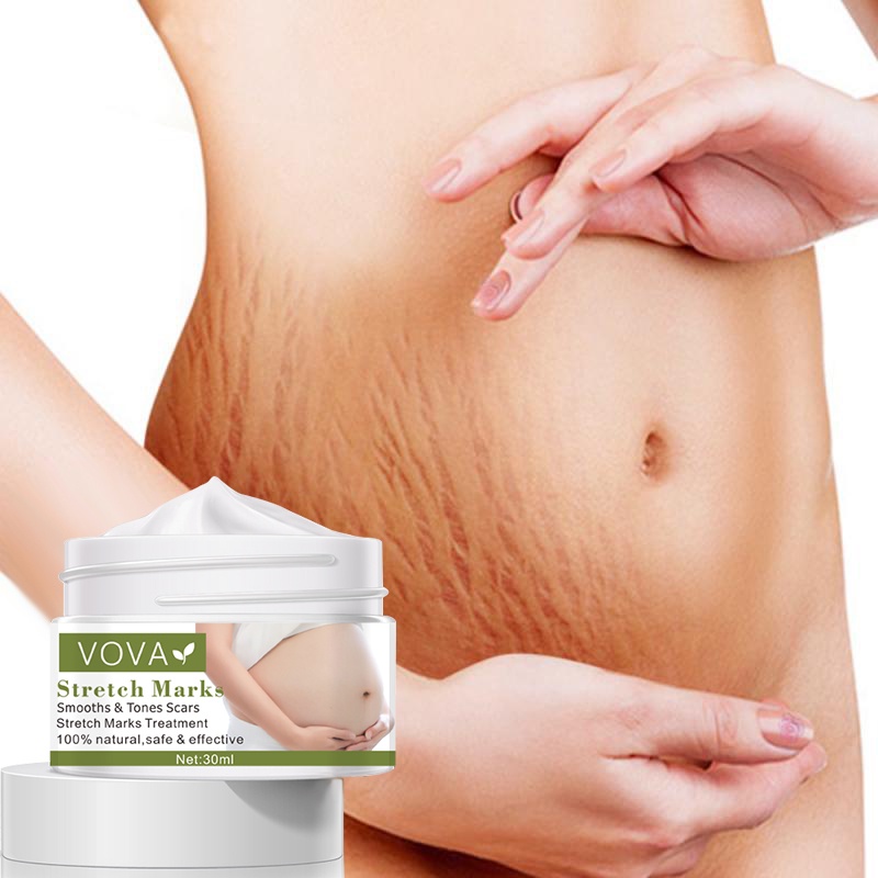 VOVA Stretch Mark Removal Cream Efektif Menghilangkan Bekas Luka Kehamilan Krim Jerawat Bersalin Anti Aging Winkles Perbaikan Firm Body Cream