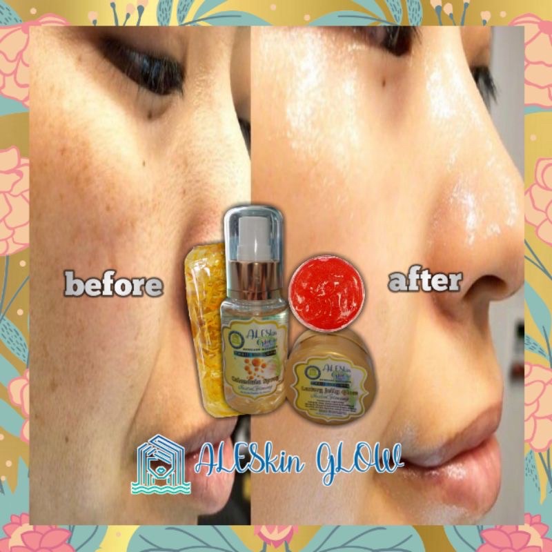 LUXURY ARBUTIN RED JELLY ALESKIN GLOW Paket Perawatan Wajah Korea-Cream Glowing-Skincare Glowing