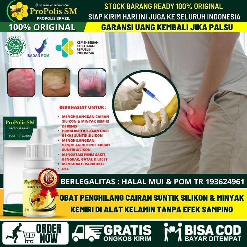 Jual Obat Oles Penis Nyeri Bengkak Alami Obat Penis Bengkak