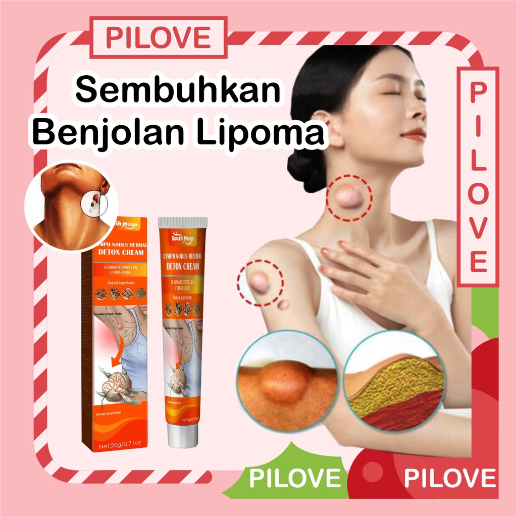 PILOVE - Obat Salep Cream Krim Untuk Penghilang Benjolan Kelenjar Getah Bening Lipoma Limfatik di Area Tubuh dan Badan Uci Uci di Leher Payudara Vagina Tangan Ketiak tanpa Operasi Ampuh