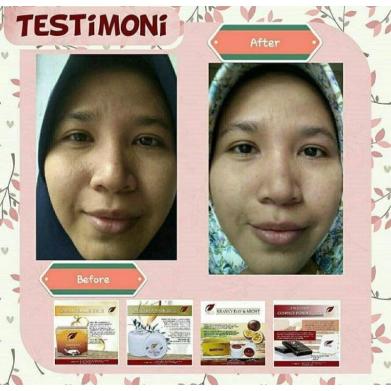 KRASNY CREAM SERIES SR12 Skincare BPOM KRIM GLOWING , MENGHILANGKAN FLEK DAN JERAWAT Aman Mencerahkan Pelembab aman Ibu hamil