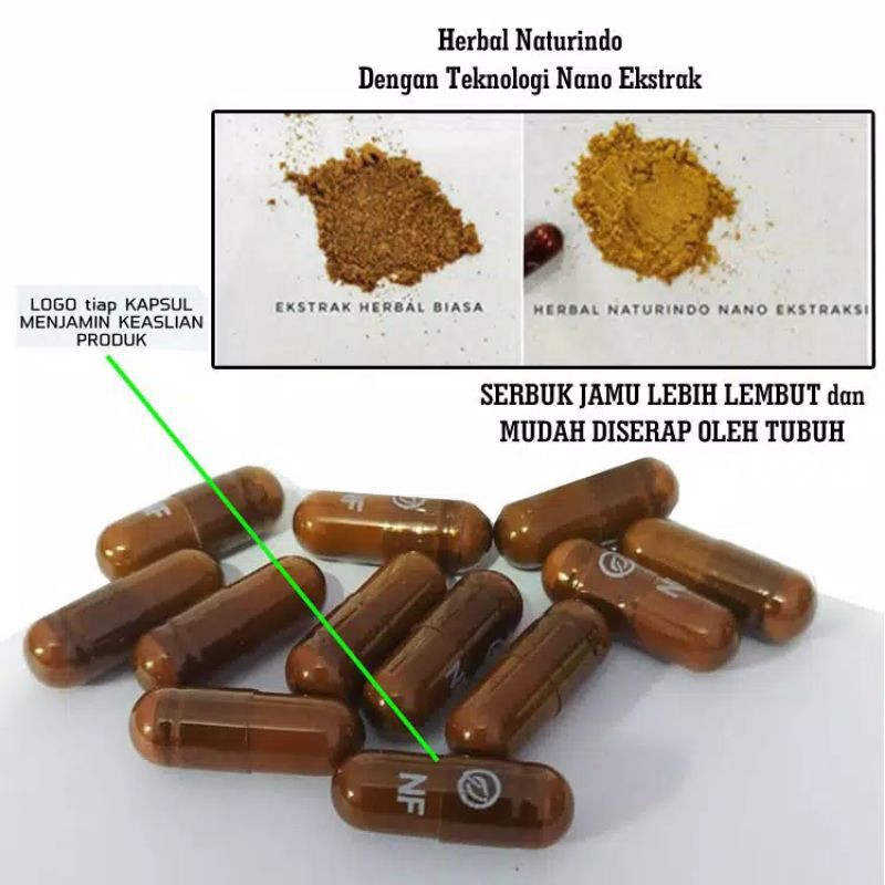 OBAT KAKI KESLEO BENGKAK TERKILIR MEMAR PATAH TULANG RETAK