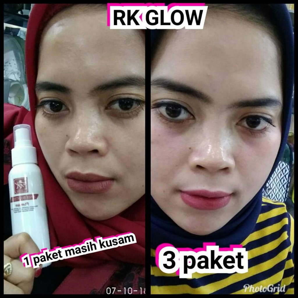 PAKET RK GLOW PREMIUM / CREAM RK GLOW ACNE / CREAM RK GLOW PREMIUM BPOM ORIGINAL 100%