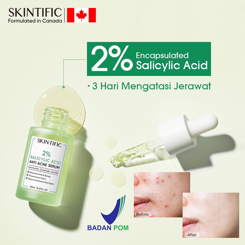 SKINTIFIC Anti Acne Serum | 2% Salicylic Acid Anti Acne Serum | Serum Jerawat